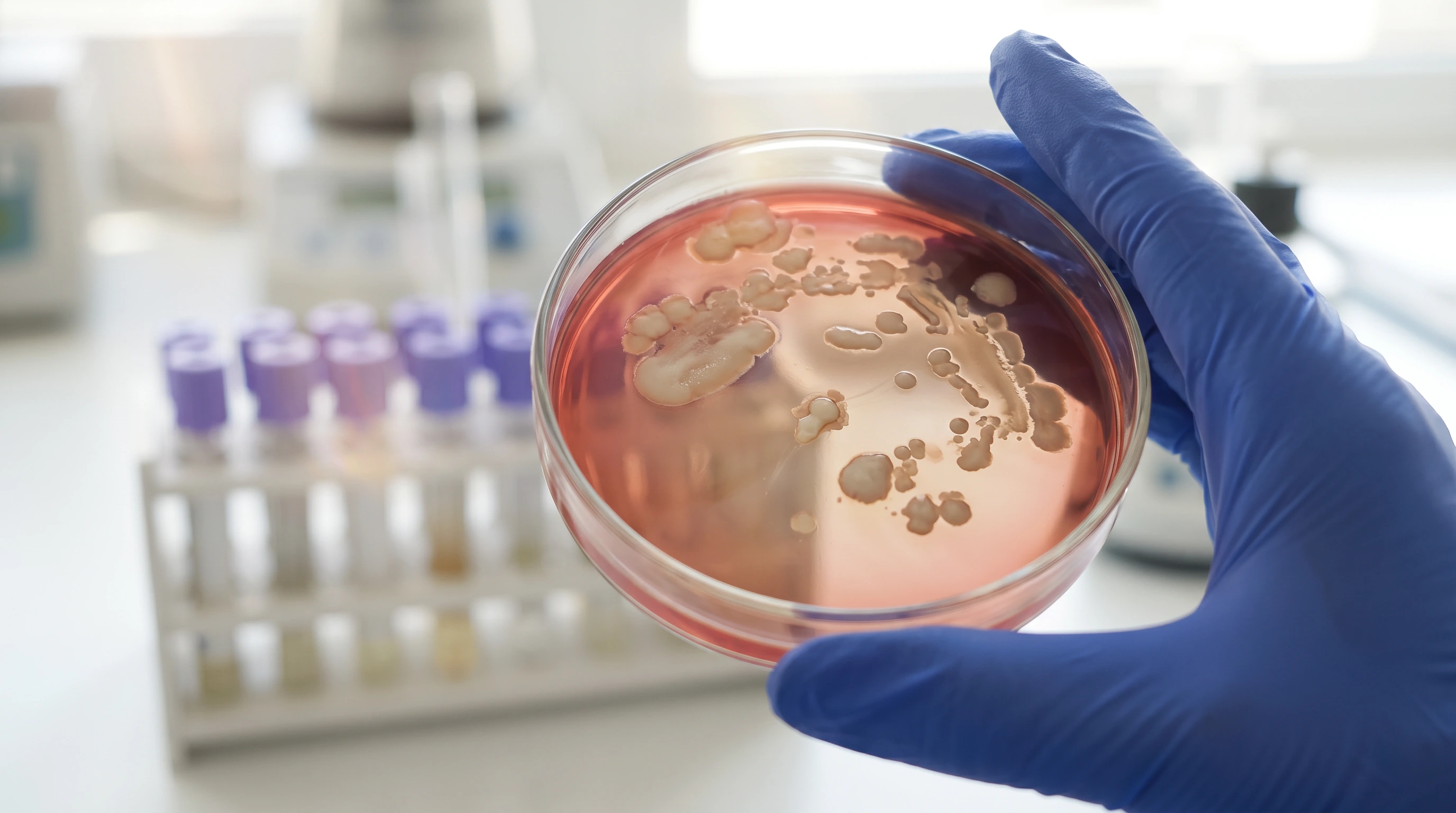 Colorado Salmonella Surge